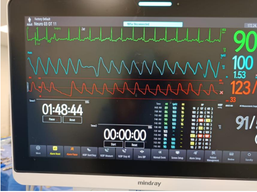 Paroxetine Induced QT Prolongation in a Patient Undergoing Lumbar Spinal Fusion Surgery